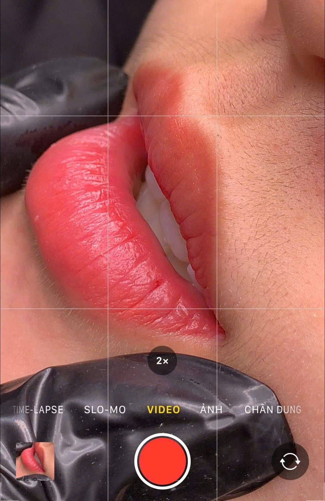 22099793985851102408