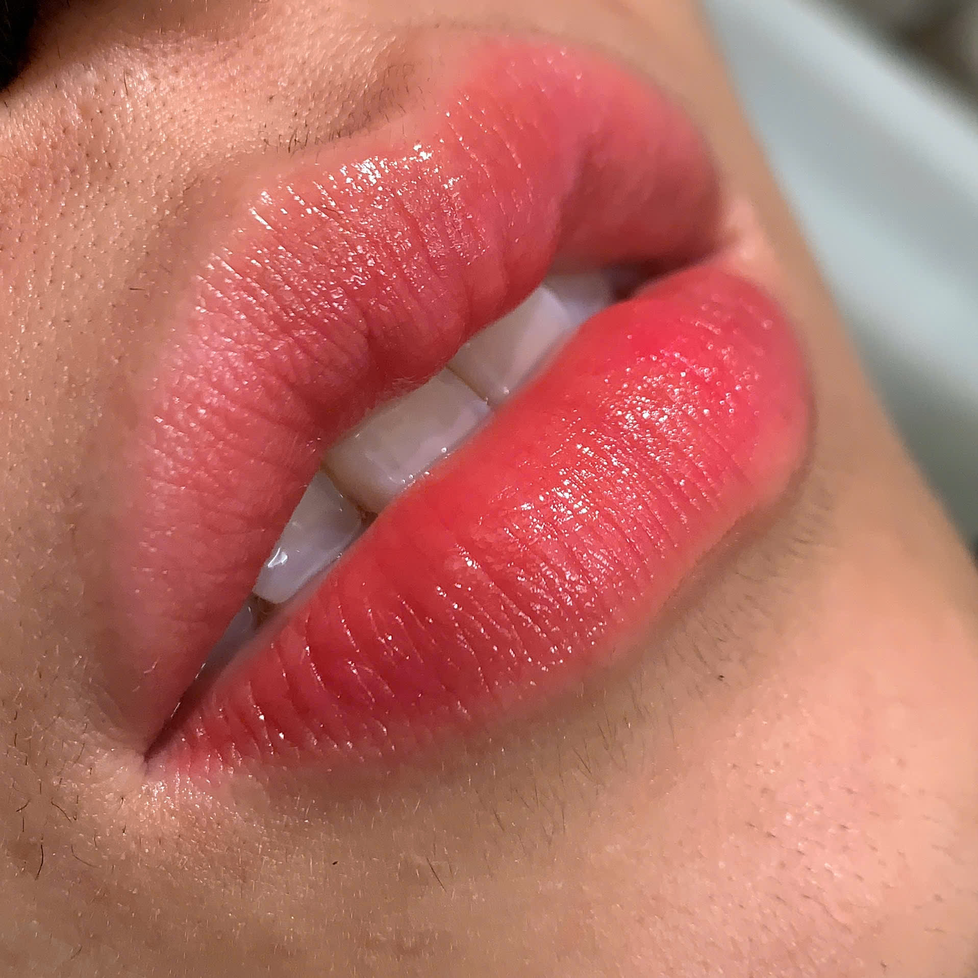 40565992270039057221