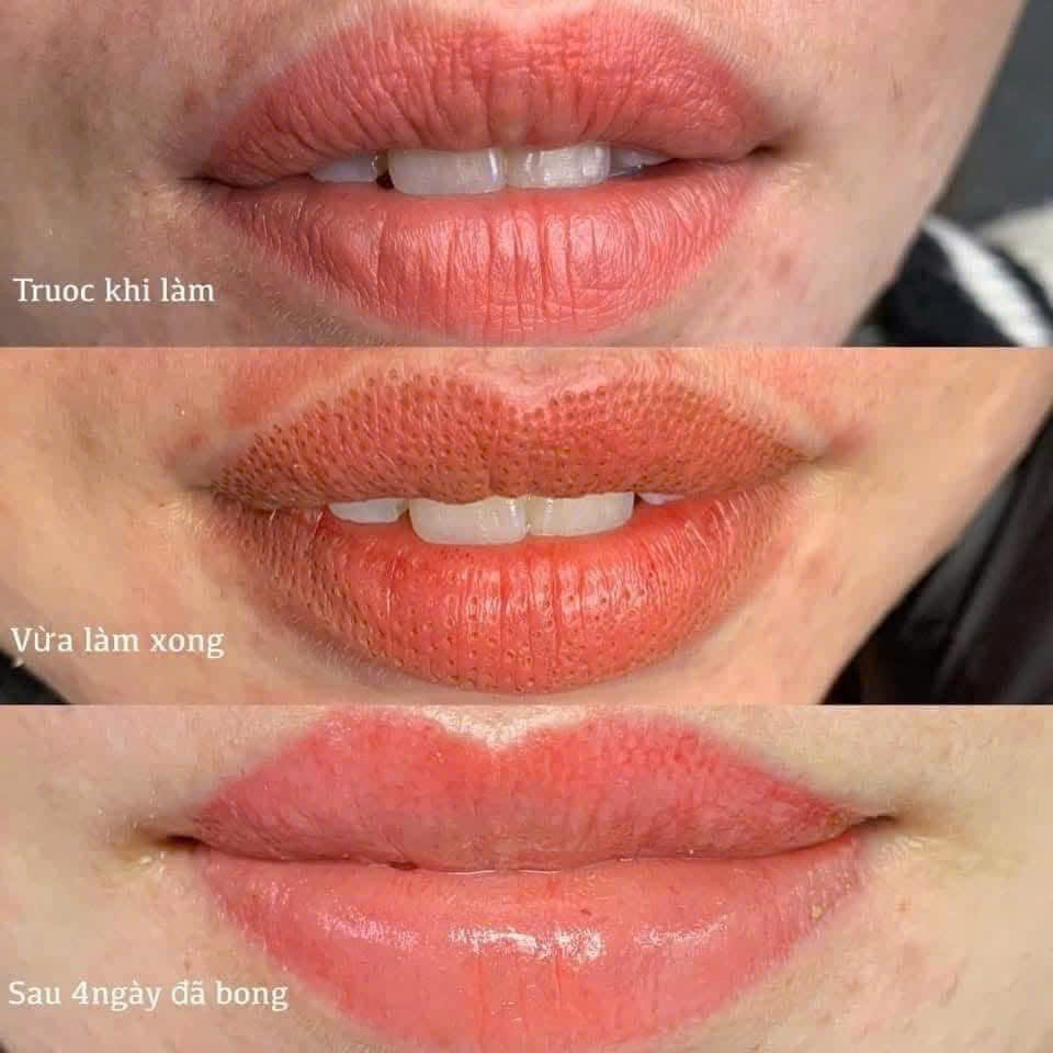 159071085926874966338