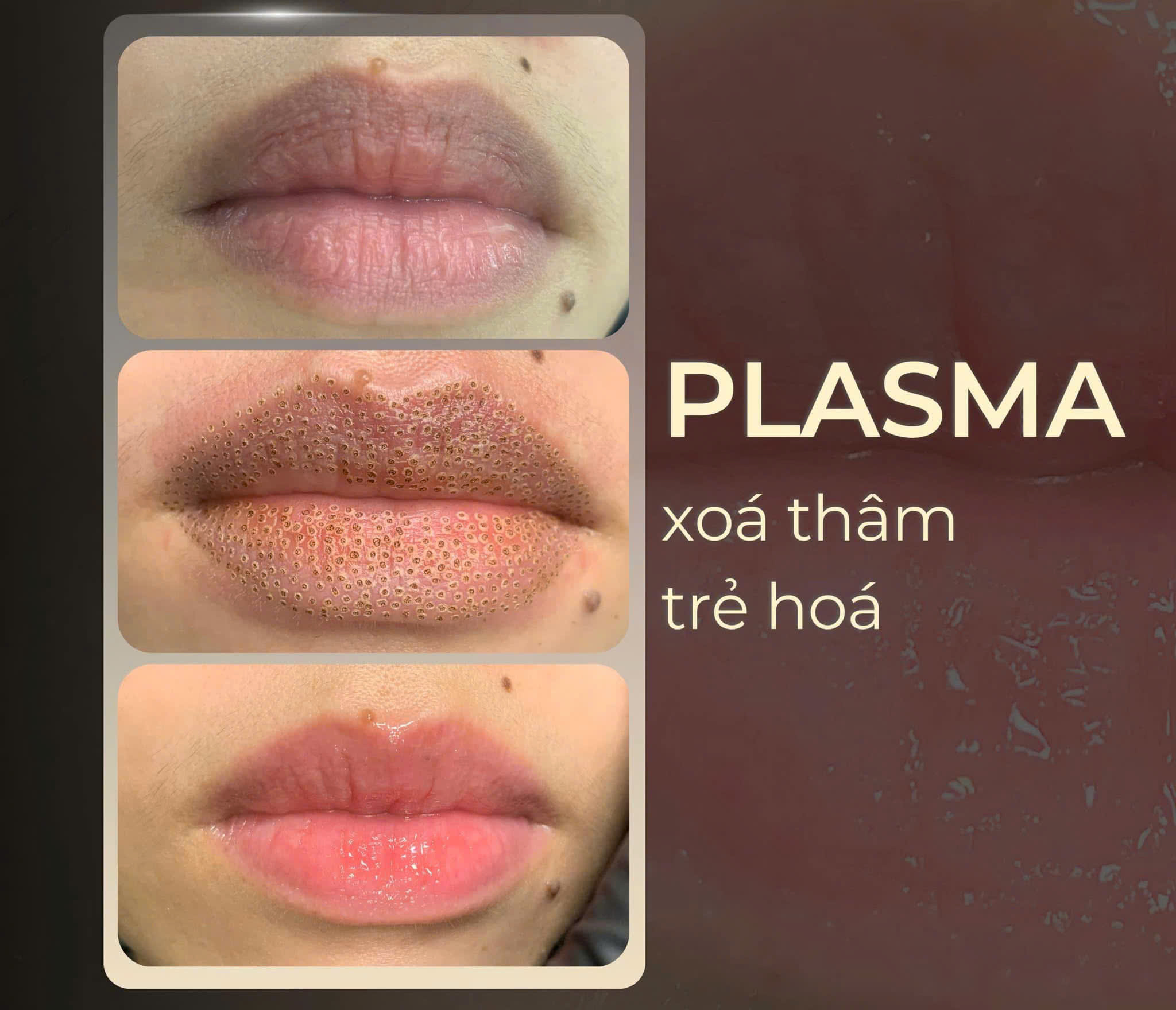 270918523436230181631