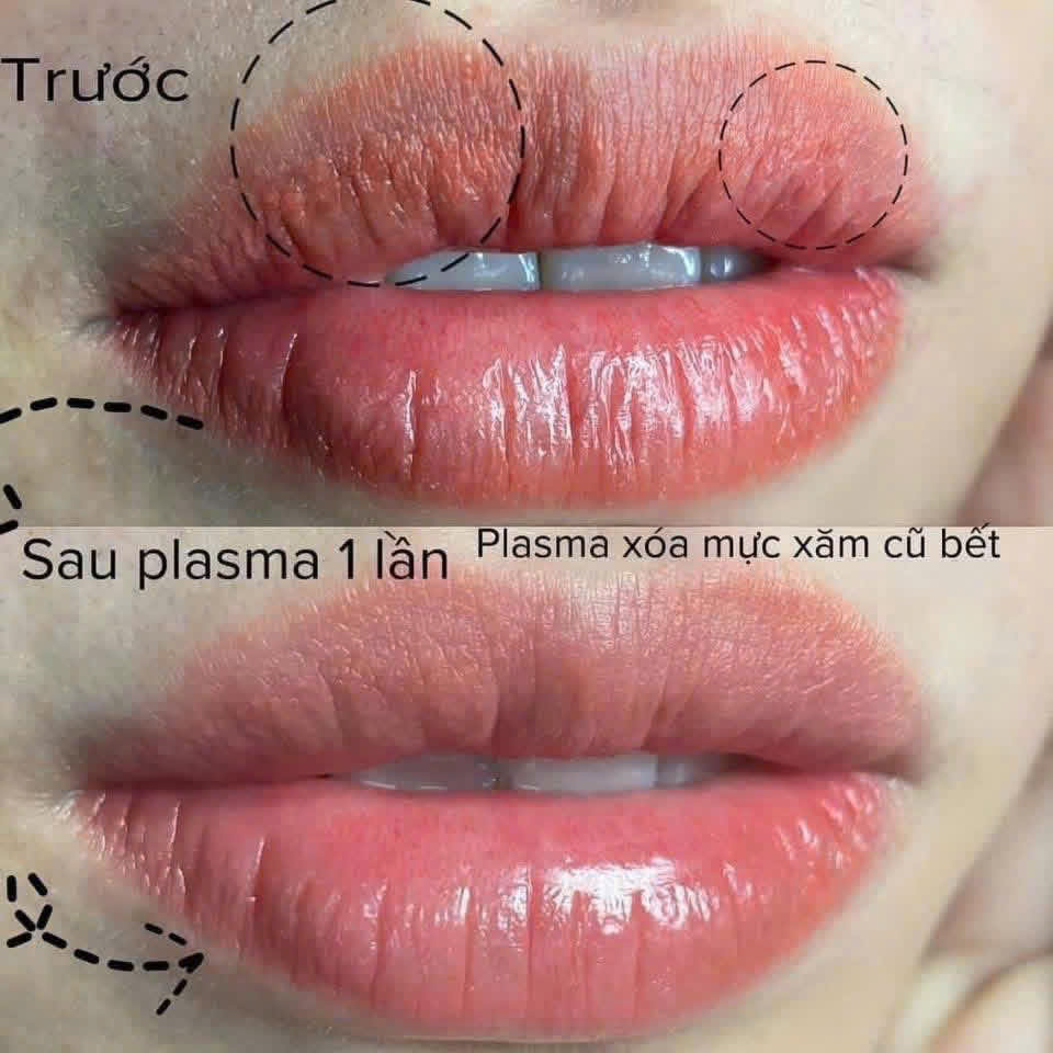 334100900699090505825