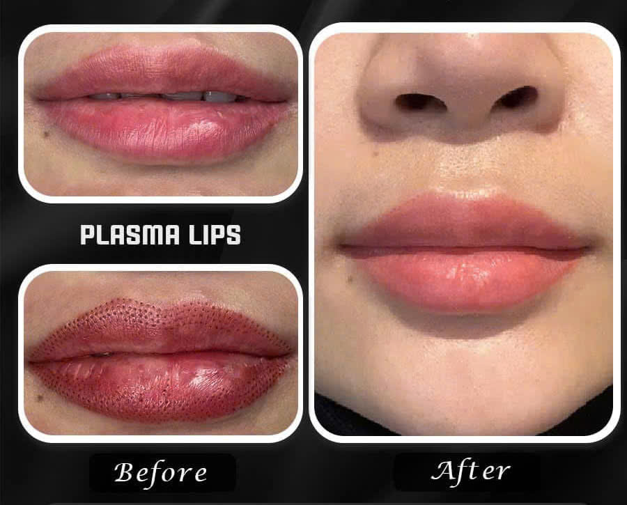 423444416094649417934