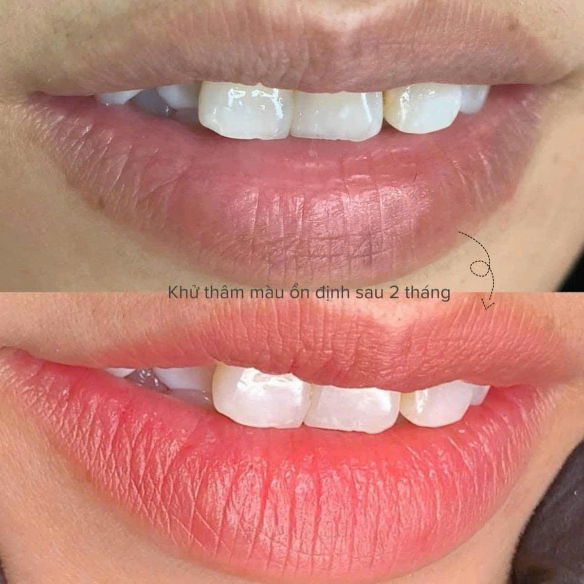 802b4466fa3674682d2714